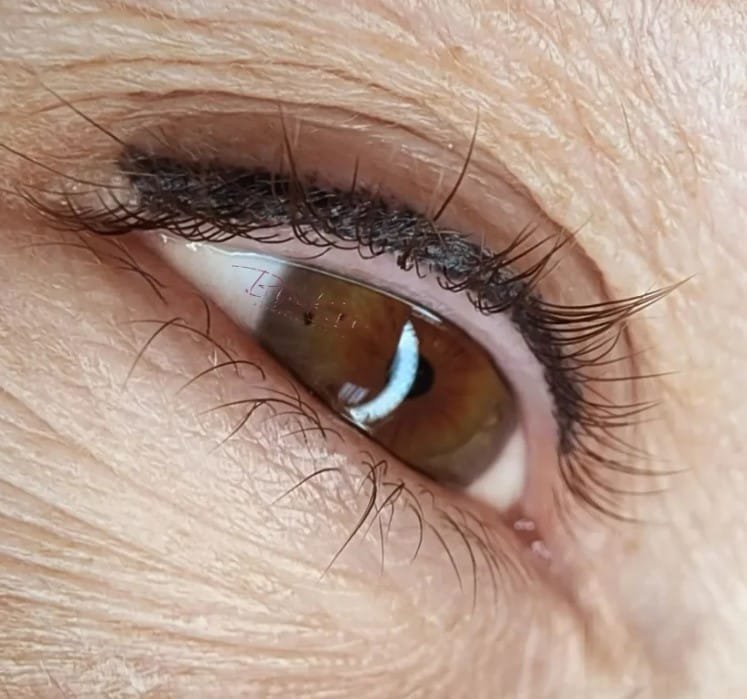 Eyeliner Tattoo Gone Wrong The Risks Of Permanent Makeup